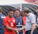 Oxlade-Chamberlain, de diez días a tres semanas de baja