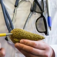 MSC-1: así es el fármaco español contra el cáncer de páncreas desarrollado en Barcelona