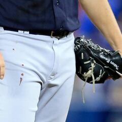 Diario de As América #269: Sangre en el montículo