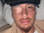 Lucas Ocampos sufre parálisis facial