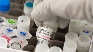 Comenzaron a probarse algunas vacunas clínicas contra el coronavirus en Estados Unidos. Te decimos cuáles han sido los avances y en qué consisten las pruebas.