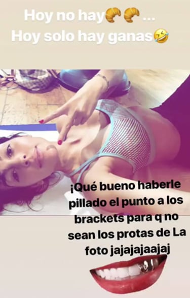 Georgina Rodrguez admite que se ha puesto brackets compartiendo una foto
