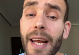 Jorge Ángel, enfermero, sobre el fin de la calvicie: “Está en ensayos pero los resultados están siendo prometedores”