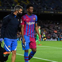 Balde no estará en Cádiz por una lumbalgia