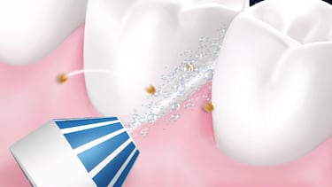 Irrigador dental: qué es, cómo se usa y cuáles son los mejores