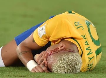 Brazil's Neymar gestures on the ground after receiving an elbow to the face by Bolivia's Yasmani Duk during the Russia 2018 World Cup football qualifier match in Natal, Brazil, on October 6, 2016. / AFP PHOTO / Nelson ALMEIDA