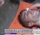 Van Persie podría perder la visión de un ojo tras fuerte codazo