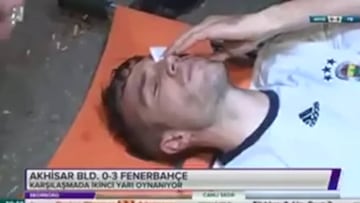 Van Persie pudo haber perdido un ojo tras recibir un codazo