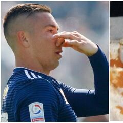 La dura imagen de la lesión de Echeverría: "Si esto es amarilla"