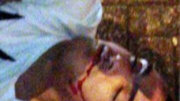 Danny Simpson, del Newcastle, inconsciente tras una pelea