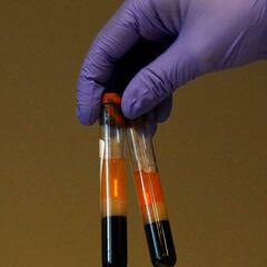 Coronavirus: Vaccine trial could be done by August, says Oxford professor