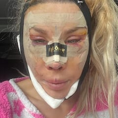 ‘La Pelopony’ muestra su rostro tras sus seis operaciones estéticas en Turquía