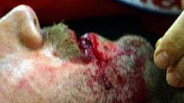 <b>NO RECORDABA NADA.</B> Aparentemente, Batistuta, que fue llevado a un hospital de manera preventiva para que le realizaran algunos exámenes, no recordaba lo sucedido antes del golpe.