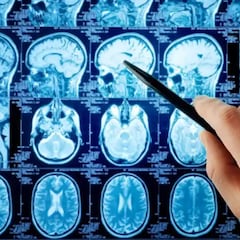 ¿Esto ya lo he vivido antes? La nueva explicación de la ciencia para los ‘déjà vu’