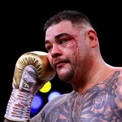 Dillian Whyte estalla contra Andy Ruiz: Es un gordo pedazo de mie...