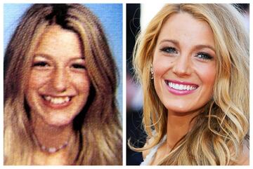 La popular actriz luce una dentadura perfecta muy distinta de la que ten赤a durante su adolescencia.