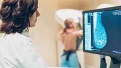 Así funcionan los programas de prevención de tres de los cánceres más frecuentes