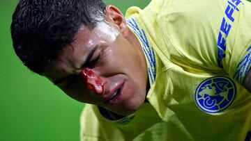 Alejandro Zendejas of America bleeds after colliding in a play during against America during their Mexican Clausura 2023 tournament football match at the Azteca stadium in Mexico City on April 8, 2023. (Photo by CLAUDIO CRUZ / AFP)