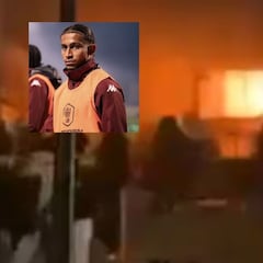 Soccer player hospitalized with severe burns after Crans-Montana fire