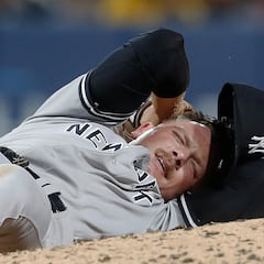 Anthony Misiewicz, de los New York Yankees, fue dado de alta tras pelotazo