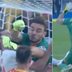 Watch: Higuaín horror blow that left Juventus player hospatilised