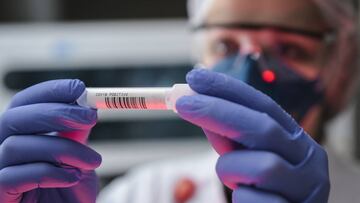 VESPASIANO, BRAZIL - JULY 07: A lab technician holds a tube with a positive sample of COVID-19 at Hermes Pardini Lab amidst the coronavirus (COVID-19) pandemic on July 7, 2020 in Vespasiano, Brazil. Hermes Pardini is the largest diagnostic medicine lab in