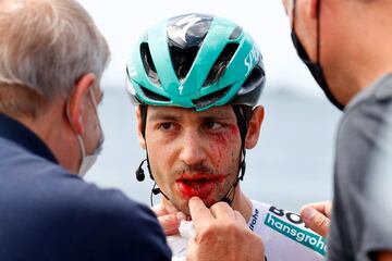 El alemán Emanuel Buchmann, es examinado después de verse involucrado en un choque masivo durante la 15ª etapa del Giro de Italia 2021, una carrera de 147 km entre Grado y Goriziav