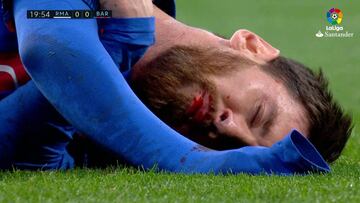 Casemiro y Marcelo pudieron ser expulsados en la 1ª mitad