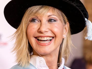 Olivia Newton-John: Todas las películas emblemáticas en las que destacó la actriz de 73 años