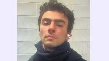 Tras ser arrestado en Pennsylvania, Luigi Mangione, el sospechoso de asesinar a Brian Thompson, enfrenta cinco cargos. Aquí la lista completa.