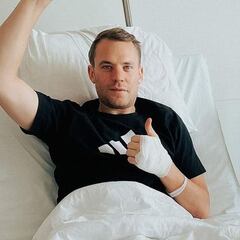 Neuer se rompe la tibia y el peroné... ¡esquiando!