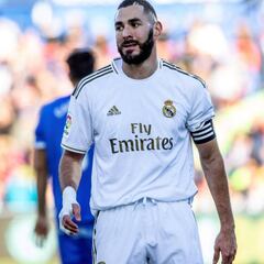 Se cumple un año de la lesión de Benzema en el meñique derecho
