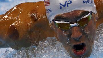 Las misteriosas manchas de Michael Phelps en Río