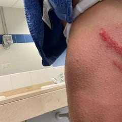 Roja de récord: Pomares fue expulsado a los 12 segundos