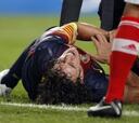 Puyol se opera de una rodilla y puede decir adiós a la campaña
