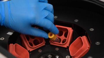 Coronavirus en Colombia en vivo: nuevos casos y muertes, últimas noticias de hoy, 25 de septiembre