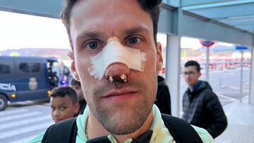 As¨ª ha quedado Pedraza tras su fractura de tabique nasal