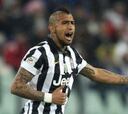 Arturo Vidal sufre sólo un golpe y sería titular en Copa Italia