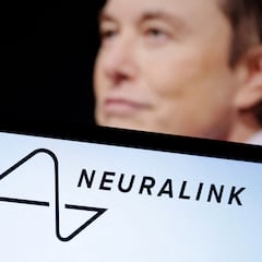 Elon Musk’s Neuralink seeks volunteers to get the chip implanted in their brain