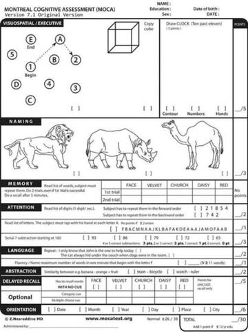 Prueba cognitiva