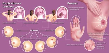 Crean un algoritmo capaz de detectar el cáncer de mama