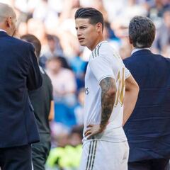 Zidane sobre lesión de James: "Hay que tener paciencia"