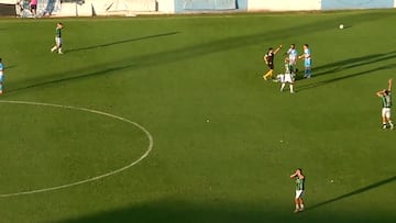 No apto para sensibles: escalofriante lesión en el fútbol argentino tras brutal entrada