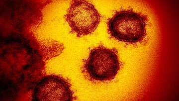 El coronavirus, a vista de microscopio.