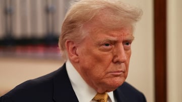 President Donald Trump has been diagnosed with chronic venous insufficiency, the White House said on Thursday.