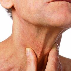 Disfagia, otra secuela de la COVID-19