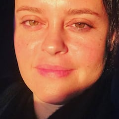 Shaila Dúrcal muestra con naturalidad su dedo amputado