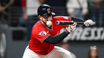 Shock en USA: hospitalizado un beisbolista por un pelotazo a 160 km/h