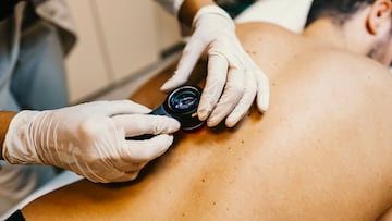 Female doctor examining patients birthmarks for skin cancer in a medical clinic.