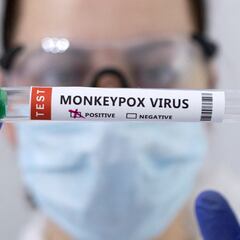 ¿Cómo se transmite la viruela del mono?: síntomas y medidas